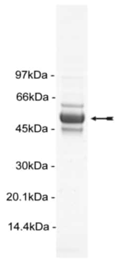 Eurofins DiscoverX Akt2/PKB ( PH, S474D) Protein, Active 250 &mu;g | Buy Online | Eurofins DiscoverX | Fisher Scientific